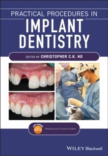 PRACTICAL PROCEDURES IN IMPLANT DENTISTRY